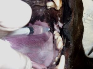 Inferior alveolar nerve block