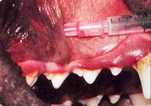 Infraorbital nerve block 1