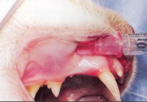 Infraorbital nerve block
