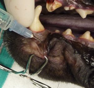 Mental nerve block