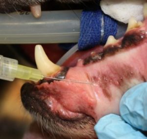 Mental nerve block