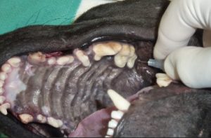 maxillary nerve block 2